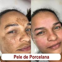 Imagem do curso Pele de Porcelana